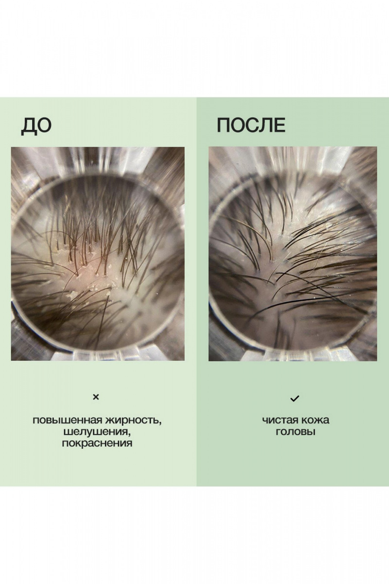 Шампуни Limba Cosmetics Detox Oily Hair Cleansing Shampoo